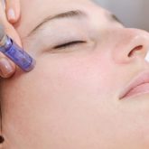 microneedling_203210908-700x500